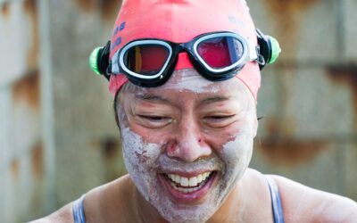 Edie Hu’s Battle Scars After Adventure Around Lantau Island